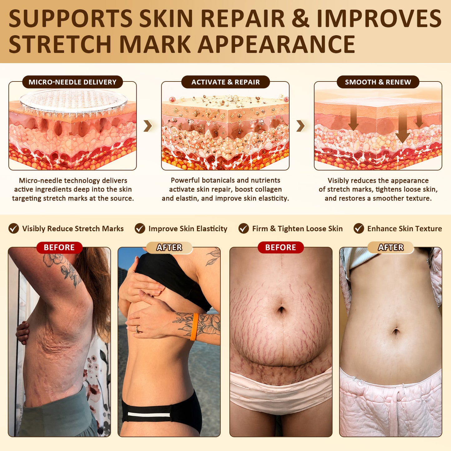 HISKIN® Bust Volume, Lift & Firming Nano Microneedle Patch Volufiline + Exosome + Copper Peptide Formula Powered by Cellular Renewal Technology