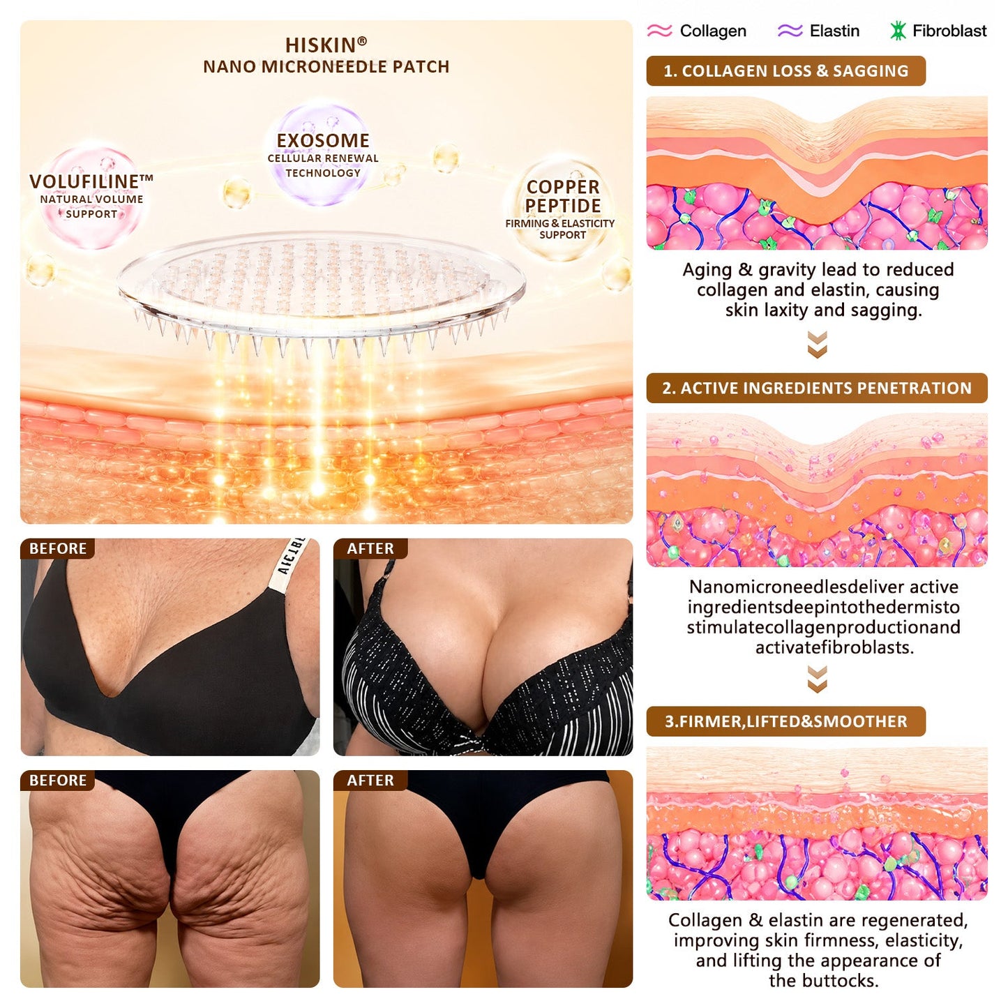 HISKIN® Bust Volume, Lift & Firming Nano Microneedle Patch Volufiline + Exosome + Copper Peptide Formula Powered by Cellular Renewal Technology