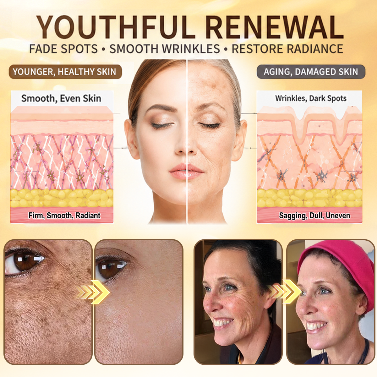 HISKIN® Bust Volume, Lift & Firming Nano Microneedle Patch Volufiline + Exosome + Copper Peptide Formula Powered by Cellular Renewal Technology