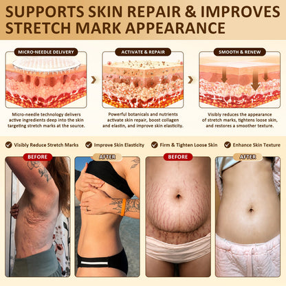 HISKIN® Bust Volume, Lift & Firming Nano Microneedle Patch Volufiline + Exosome + Copper Peptide Formula Powered by Cellular Renewal Technology