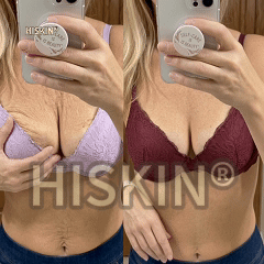 HISKIN® Bust Volume, Lift & Firming Nano Microneedle Patch Volufiline + Exosome + Copper Peptide Formula Powered by Cellular Renewal Technology