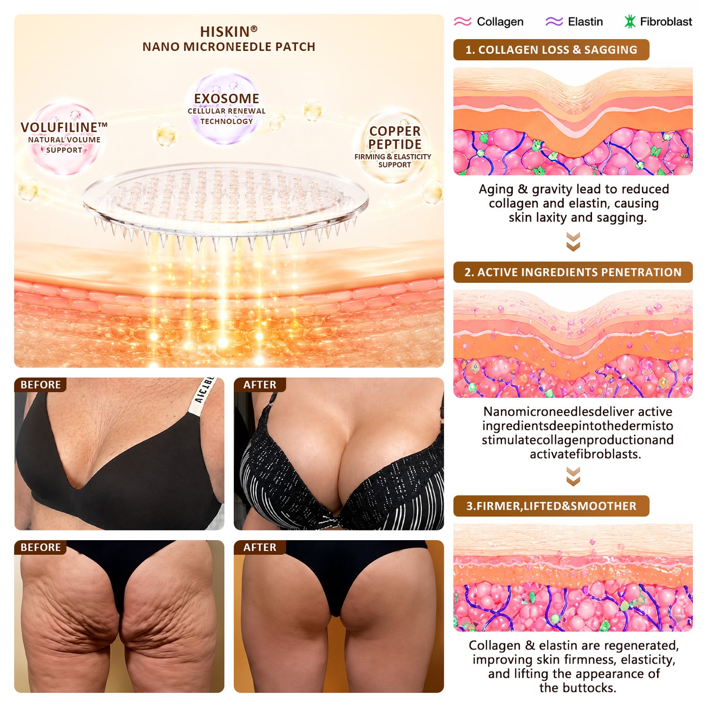 HISKIN® Bust Volume, Lift & Firming Nano Microneedle Patch Volufiline + Exosome + Copper Peptide Formula Powered by Cellular Renewal Technology