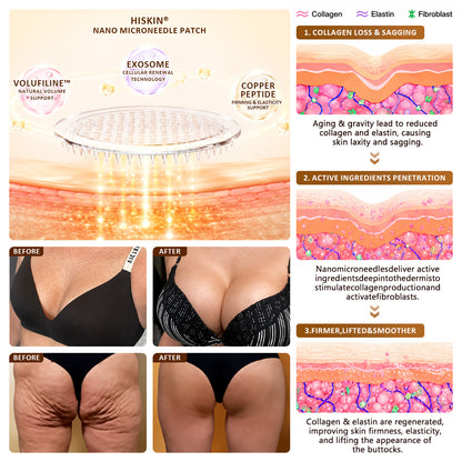 HISKIN® Bust Volume, Lift & Firming Nano Microneedle Patch Volufiline + Exosome + Copper Peptide Formula Powered by Cellular Renewal Technology